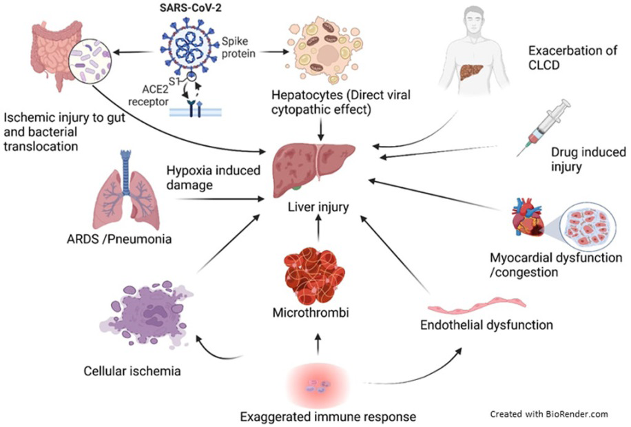 Figure 14: Hepatic Disorders and COVID-19.