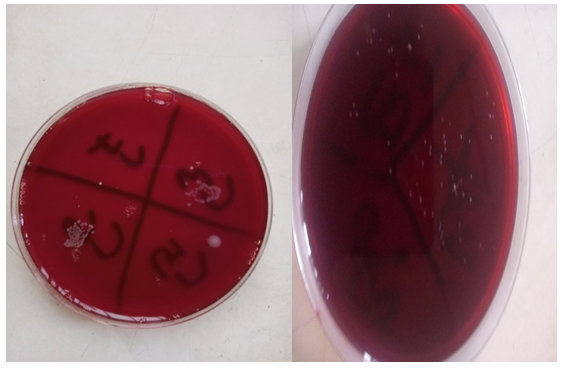 Figure 1: Stapylococcus aureus growth on blood agar plates.