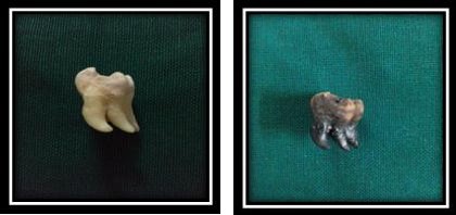 Figure 1: Before incineration. After incineration.