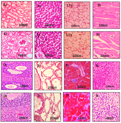 Figure 6: Photomicrographs of H & E stained (100x) section some vital organs of rats after 28 days subchronic toxicity study at 400 mg/kg b.w. A. absinthium extract. Kc, Kt: kidney control group, kidney treatment group, Lc, Lt: liver control group, liver treatment group, Luc, LUt: lung control group, lung treatment group, Hc, Ht: heart control group, heart treatment group, Oc, Ot: ovary control group, ovary treatment group, Tc, Tt: testes control group, testes treatment group, Pc, Pt: pancreas control group, pancreas treatment group, Sc, St: spleen control group, spleen treatment group.