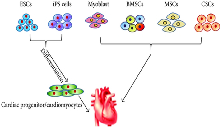 Figure 1: Various types of SCs used in cardiac regenerative therapy PSCs, including the ESCs and iPSCs, are generally differentiated into CMs for heart failure therapy.