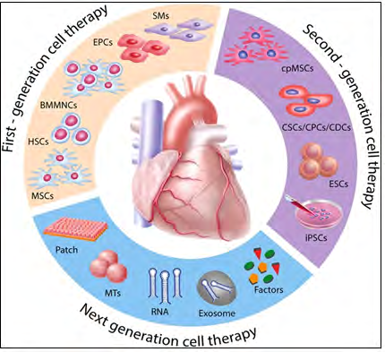 Figure 2: Evolution of translational cell driven cardiac regenerative therapies First generation cell types such as SMs, BMMNCs, HSCs, EPCs, and MSCs demonstrated feasibility and safety with, however, heterogeneous outcomes and limited efficacy in the clinical setting. In order to better match the target organ, second-generation cell therapies propose the use of cpMSCs, CSCs/CPCs, and CDCs, and pluripotent stem cells such as ESCs and iPSCs. Next-generation therapies for cardiac repair are directed toward cell enhancement (e.g., biomaterials, 3D cell constructs, cytokines, miRNAs) and cell free concepts (e.g., growth factors, noncoding RNAs, extracellular vesicles, and direct reprograming SMs, skeletal myoblasts; BMMNCs, bone marrow mononuclear cells; HSCs, hematopoietic stem cell; EPCs, endothelial progenitor cell; MSCs, mesenchymal stem cells; cpMSCs, chorionic plate derived mesenchymal stem cells; CSCs/CPCs, cardiac stem cell: cardiac progenitor cell ration; CDCs, cardiac dendritic cell; ESCs, embryonic stem cells; iPSCs, induced pluripotent stem cell; RNA, ribonucleic acid.