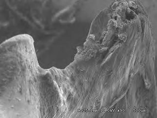 Figure 11: Dorsal view of stage 2 weathering on anterior sacral depressio-n (civil case sample) at 10 kV 45X magnification.