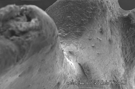 Figure 12: Sacrum (dorsal right view) (civil case sample) at 10 kV 120X magnification.