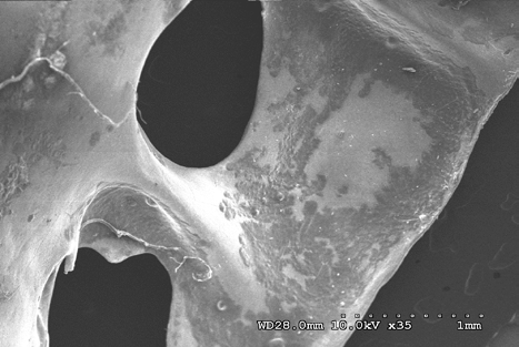 Figure 13: Sacrum, tubercles, and sacral groove (sulcus and linear ridge-dorsal right view) (civil case sample) at 10 kV 35X magnification.