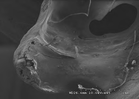 Figure 15: Fissures and several posterior sacral foramina on a depression at (civil case sample) 10 kV 45X magnification.