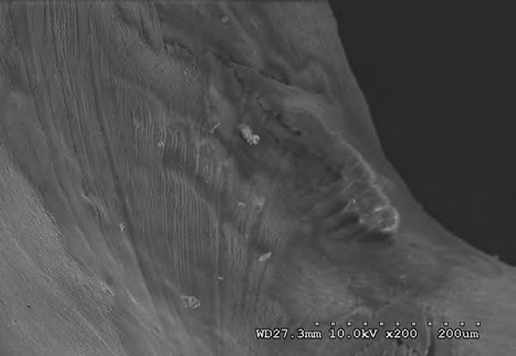 Figure 16: Dorsal view of stage 2 weathering on sacral depression (civil case sample) at 10 kV 200X magnification.