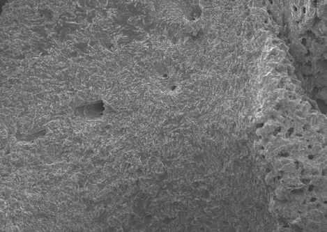 Figure 21: Dorsal view of sacrum and foramen (heat and chemical dried sample) at 10 kV 120x magnification.