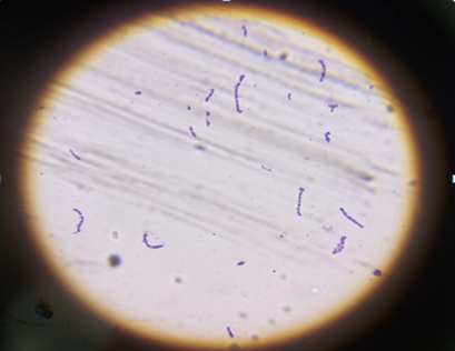 Figure 10: Gram staining and microscopy of S. pneumoniae.