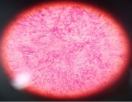 Figure 12: Gram staining and microscopy of Kleibsella spp.