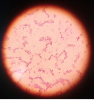 Figure 14: Gram staining and microscopy of E. coli on the media.