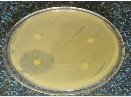 Figure 17: Antibiotic susceptibility test of E. coli showed that it is intermediate to Cefotaxime and resistant to Ceftriaxone and Azithromycin.
