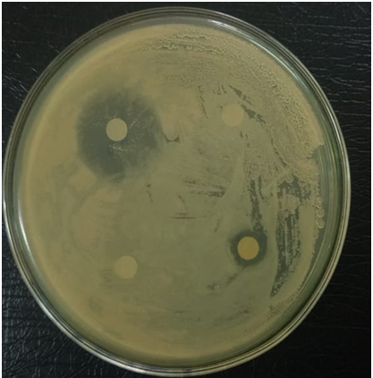 Figure 18: Antibiotic susceptibility test of Klebsiella showed that it is resistant to Cefotaxime and resistant to Ceftriaxone and Azithromycin.