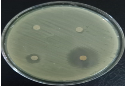Figure 19: Antibiotic susceptibility test of S. aureus showed resistant to all antibiotics used.