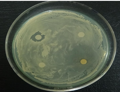 Figure 20: Antibiotic susceptibility test of S. pneumoniae showed that it is resistant to all antibiotics used.