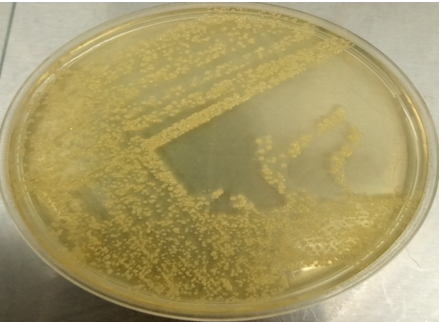 Figure 4: Colony morphology of S.aureus on Nutrient agar.