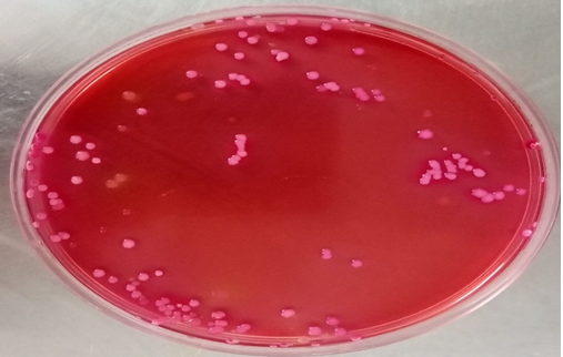 Figure 6: Colony Morphology of K. Pneumoniae on Macconkey Agar.