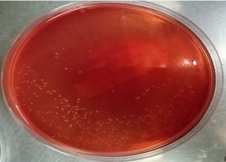 Figure 7: Colony Morphology of E. Coli on Macconkey Agar.