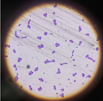 Figure 8: Gram staining and microscopy of S. aureus.