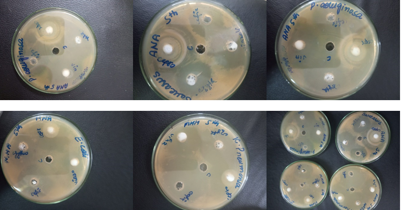 Figure 4: Antibiotic susceptibility testing of Extracts and antibiotics against selected pathogens by well diffusion methods.