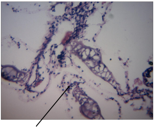 Figure 3: Gill of an infected juvenile showing erosion of secondary lamellae (black arrow) (H&E X 400).