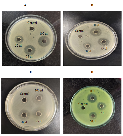 Figure 2: Antibacterial activity of chitosan at different concentrations on zone of inhibition in various bacterial species tested. Data represents mean of triplicate repeats of three determinations (mean ± SD).