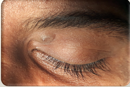 Figure 1: Gross appearance of swelling.