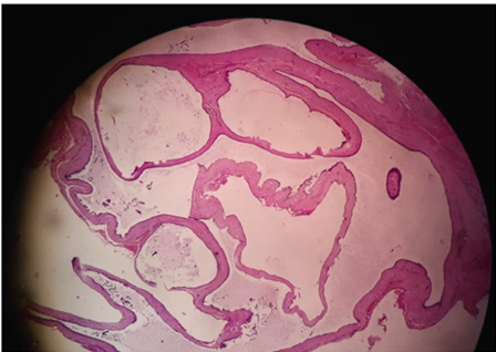 Figure 3: Low magnification view.