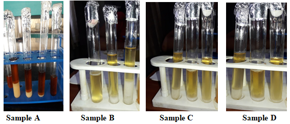 Figure 4: Growth at different NaCl Concentration (A,B,C and D).