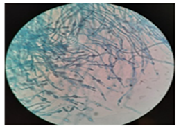 Figure 15: (A1).
