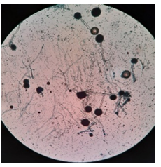 Figure 16: (A2).