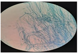 Figure 17: (A3).
