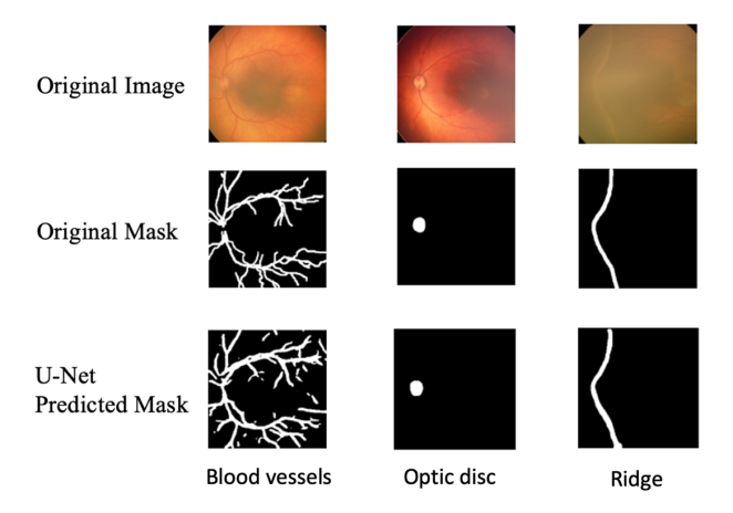 Figure 2: Comparison between the manually annotated segmentation mask and the U-Net-produced segmentation mask when U-Net is in its best configuration. The original image and its associated manual label from the test set are presented in the first two columns. The third column shows the segmentation output of U-Net’s best-performing configuration.