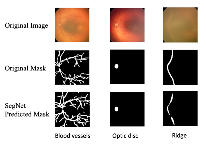 Figure 3: Comparison between the manually annotated segmentation mask and the Seg-Net-produced segmentation mask when Seg-Net is in its best configuration. The original image and its associated manual label from the test set are presented in the first two columns. The third column shows the segmentation output of Seg-Net’s best-performing configuration.