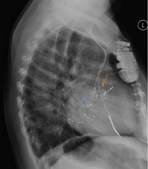 Figure 13