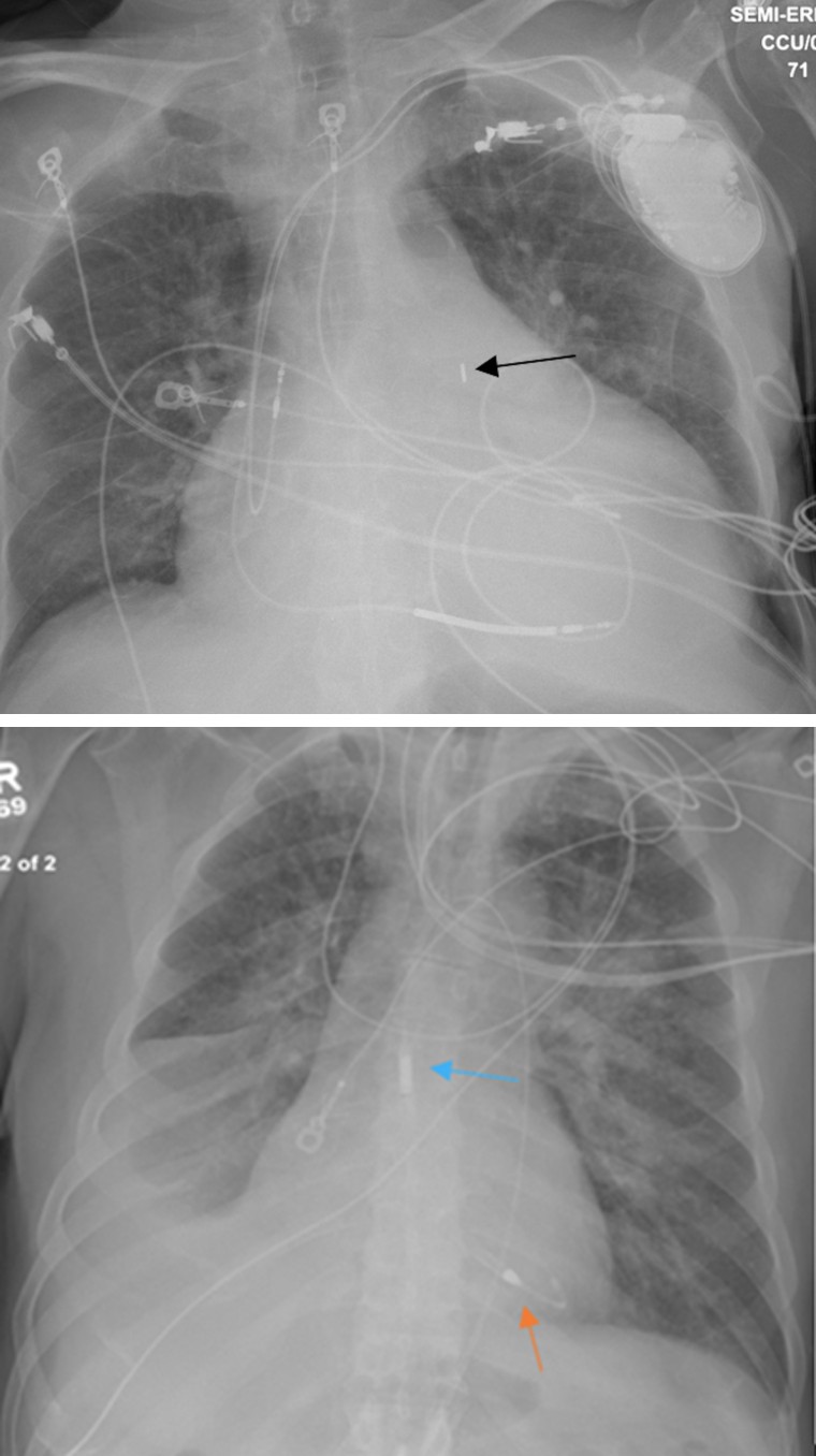 Figure 21