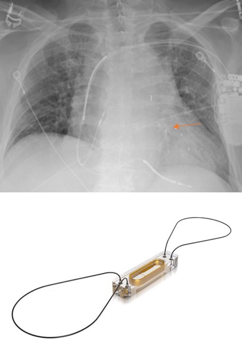 Figure 26