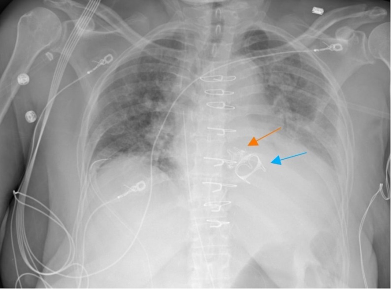 Figure 7