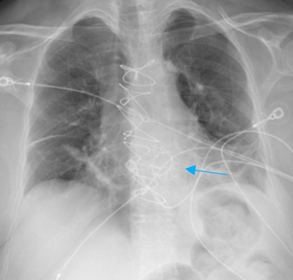 Figure 9