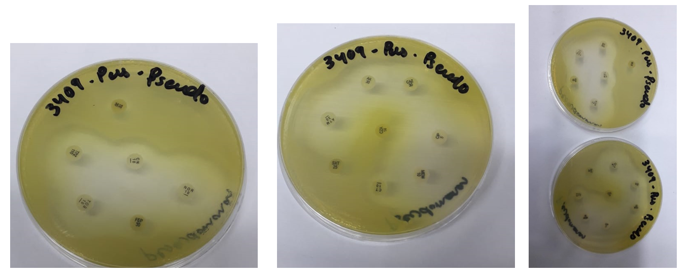 Figure 1: Antibiotic susceptibility testing of P. aureginosa.