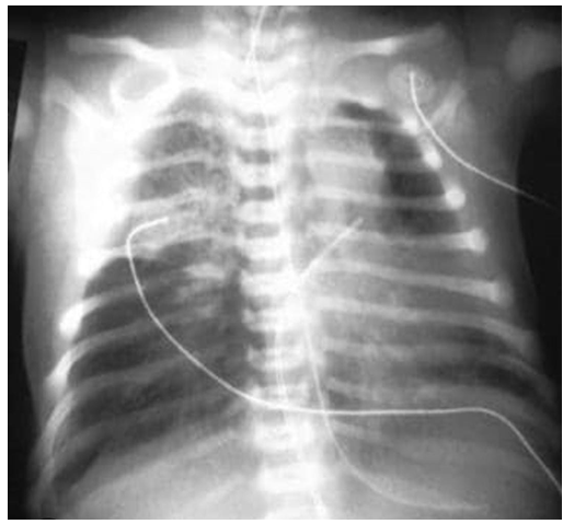 Figure 6: CXR-HMD.