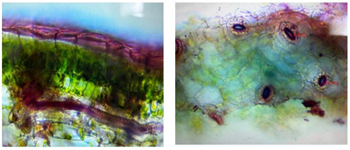 Figure 2: Epidermal cells, Stomata and mesophyll tissue of leaves of Hibiscus rosa-sinensis L.