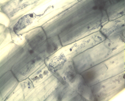 Figure 3: Fragment Amplified for _S. Subterranea_ witht First Ssr-Ssf (A) and Spo8-Spo9 (B) from _S. Tuberosum_ (the Other Fragments Correspond to Plant Amplicons).