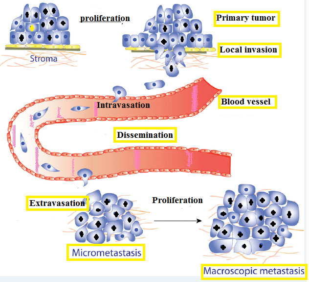 Figure 1: Tumor to metastatis.