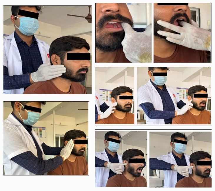 Figure 1: Extraoral Examination.