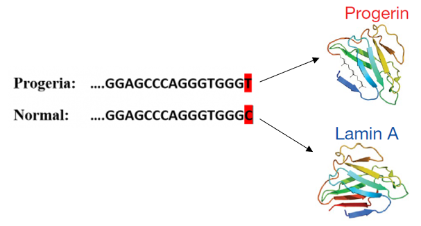 Figure 4: Normal gene vs Progeria gene.