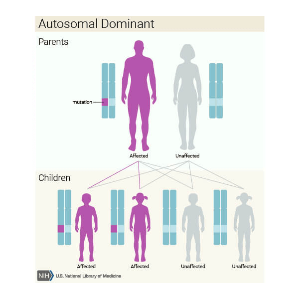 Figure 6: above Diagram’s showing mode of inheritance of progeria.