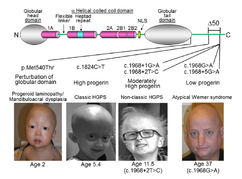 Figure 7: Diagram showing HGPS Cell & Normal Cell.