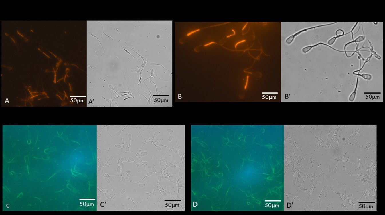 Figure 3: Immunocytochemical localization of four SMR polypeptides-Fluorescence and phase-contrast images of bovine cauda sperm immunostained with anti-SMR56 (A and A’), anti-SMR54 (B and B’), anti-34kDa VDAC2 (C and C’), and anti-31kDa VDAC3 (D and D’) antibodies exhibited intense staining of the midpiece segment of the tail. Bar=50 µm.