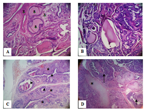 Figure 2: Photomicrograph of Benign mixed mammary gland tumour.